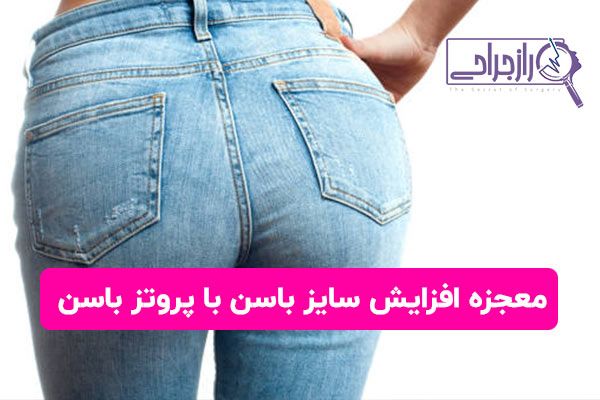 معجزه افزایش سایز باسن با پروتز باسن 1 معجزه افزایش سایز باسن با پروتز باسن