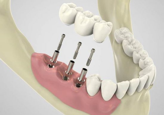 تلفظ صحیح کلمات