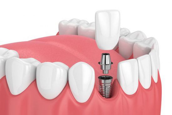 تضمین سلامت فک