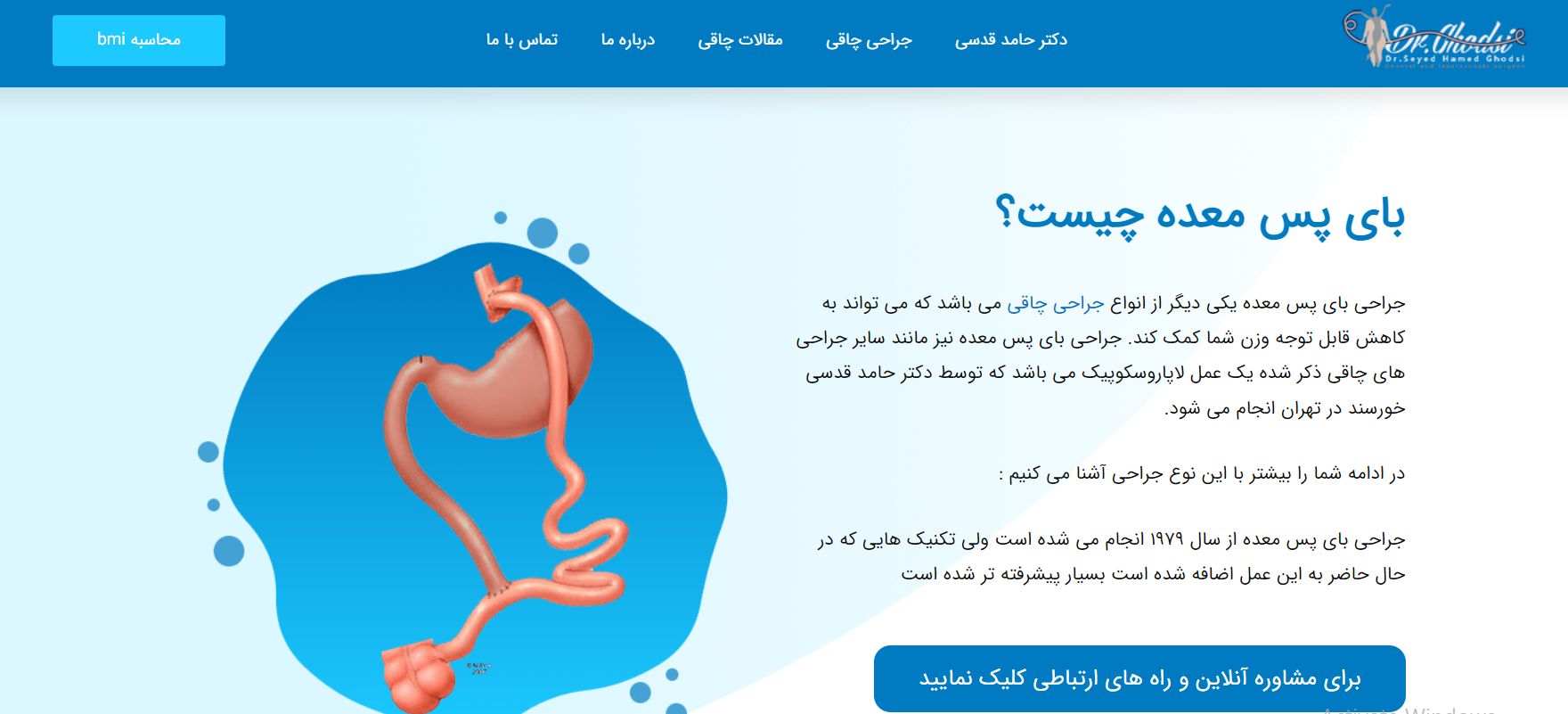 هزینه عمل مینی بای پس معده توسط جراح چاقی 4 عمل بای پس دکتر قدسی