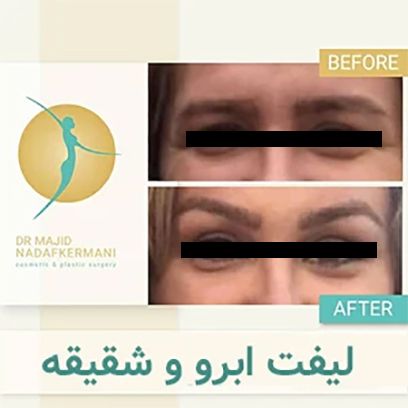 بهترین زمان اقدام برای جوانسازی چهره