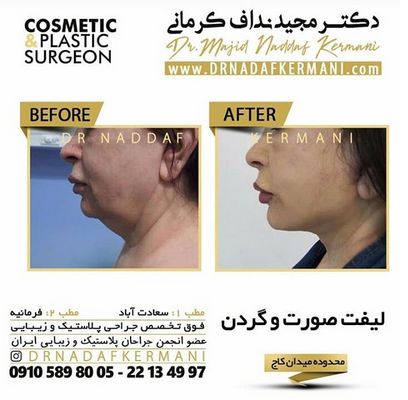 نکاتی که برای جلوگیری از پیری پوست باید رعایت کنید